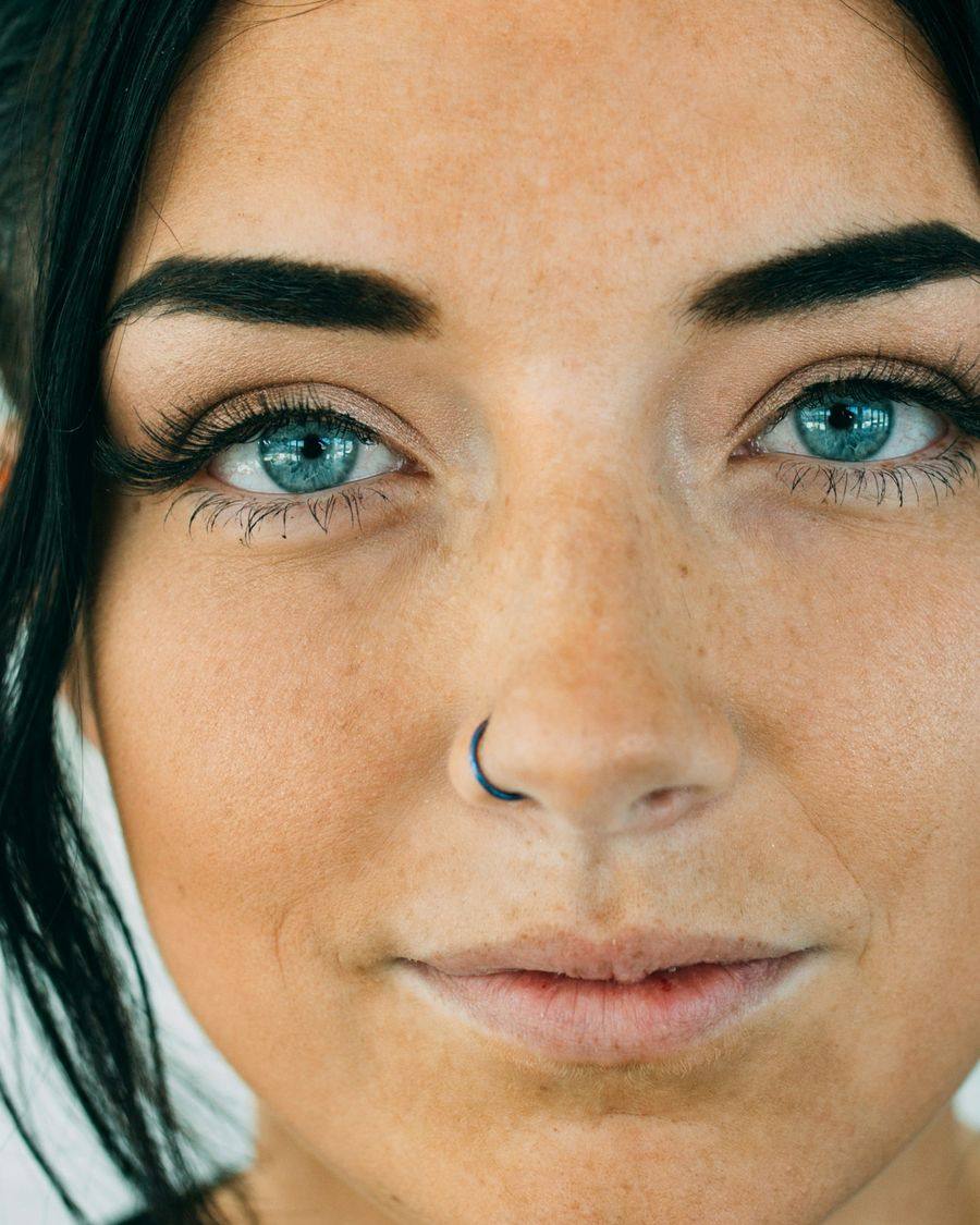 Skin close-up after treatment, placeholder image 2