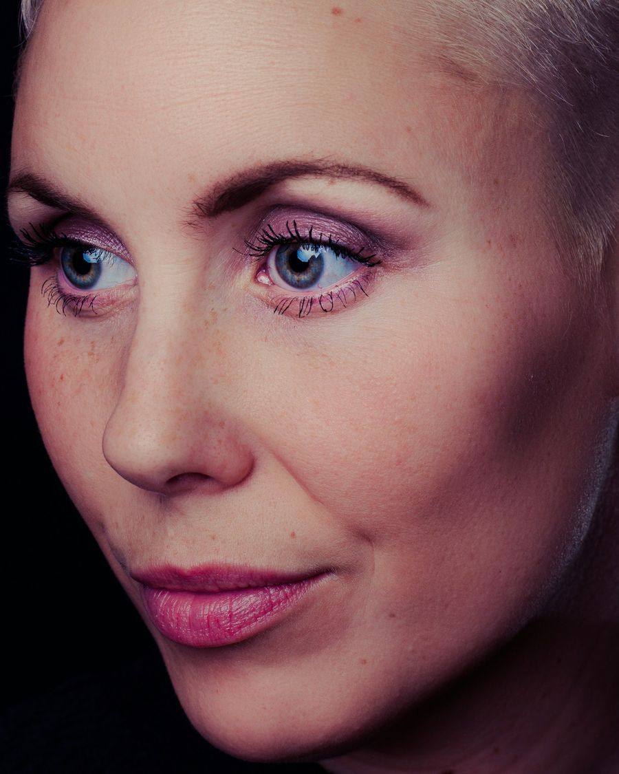 Skin close-up after treatment, placeholder image 3