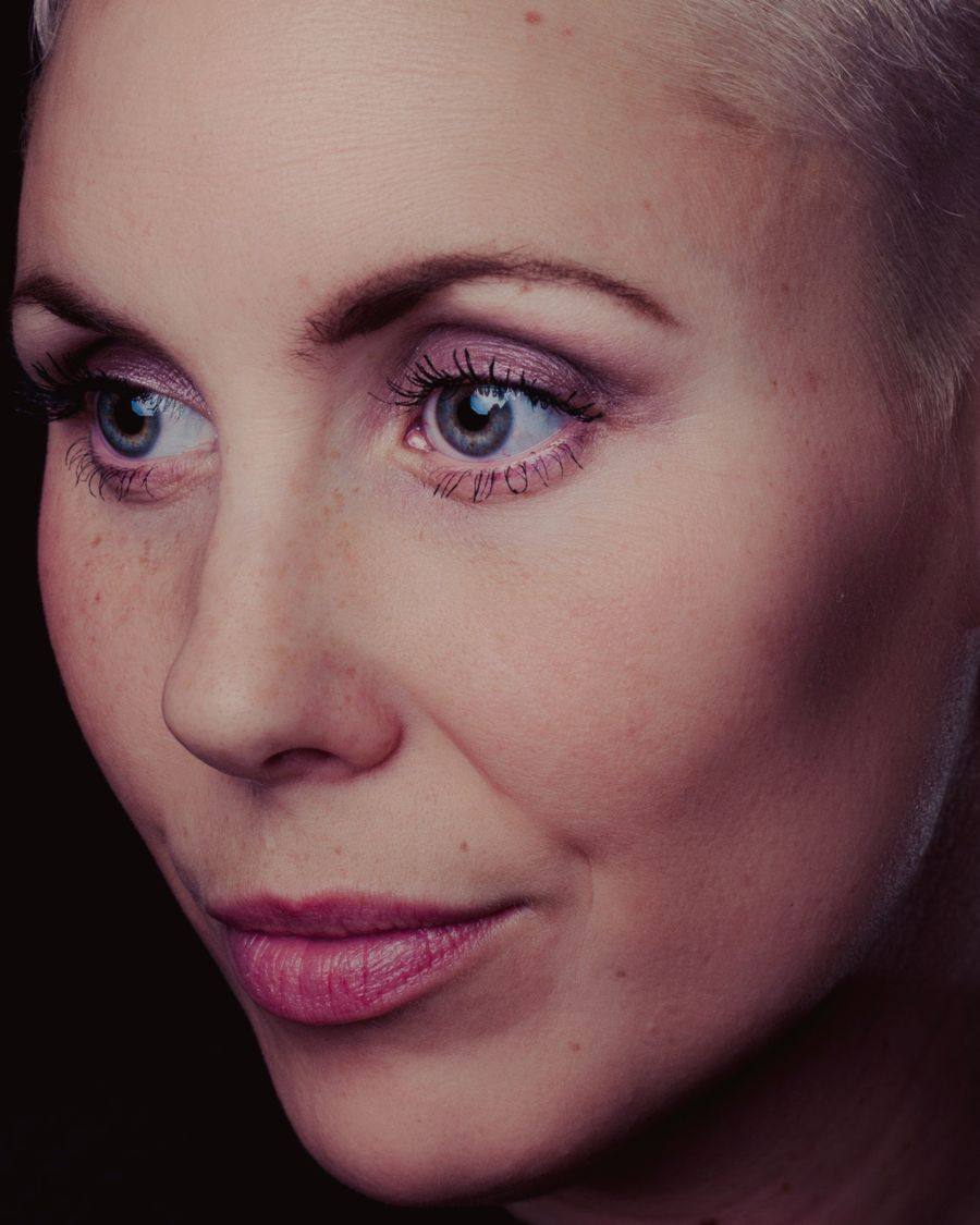 Skin close-up before treatment, placeholder image 3